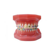 TM-B6-02 Ortho Model with Half Metal and Half Ceramic Bracket